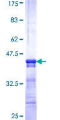 12.5% SDS-PAGE Stained with Coomassie Blue.