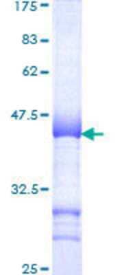 Other Recombinant Human SMARCC1 GST (N-Term) Protein