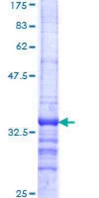 SDS-Page: Recombinant Human SMARCD2 Protein [H00006603-Q01] - 12.5% SDS-PAGE Stained with Coomassie Blue.