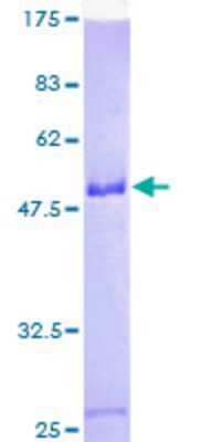 SDS-PAGE Recombinant Human SNRP70 GST (N-Term) Protein