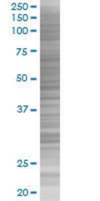 SNTB2 transfected lysate.
