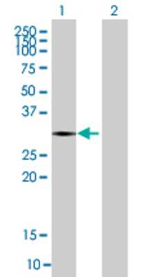 Lane 1: SNTB2 transfected lysate (29.48 KDa) Lane 2: Non-transfected lysate.