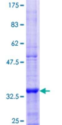 12.5% SDS-PAGE Stained with Coomassie Blue.