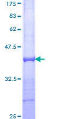 SDS-Page: Recombinant Human SorLA Protein [H00006653-Q01] - 12.5% SDS-PAGE Stained with Coomassie Blue.