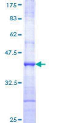 12.5% SDS-PAGE Stained with Coomassie Blue.