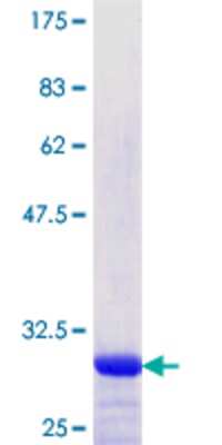 12.5% SDS-PAGE Stained with Coomassie Blue.