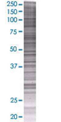 SOX12 transfected lysate.