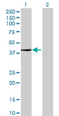 Lane 1: SOX12 transfected lysate (34.76 KDa) Lane 2: Non-transfected lysate.