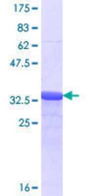 12.5% SDS-PAGE Stained with Coomassie Blue.