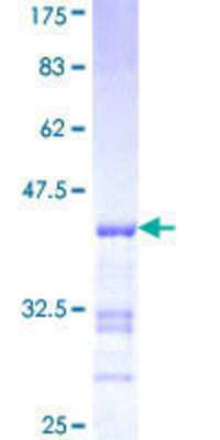 SDS-Page: Recombinant Human UAP1 Protein [H00006675-Q01] - 12.5% SDS-PAGE Stained with Coomassie Blue.