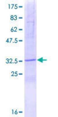 SDS-Page: Recombinant Human SPINK2 Protein [H00006691-P01] - 12.5% SDS-PAGE Stained with Coomassie Blue.
