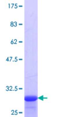 SDS-Page: Recombinant Human SPINK2 Protein [H00006691-Q01] - 12.5% SDS-PAGE Stained with Coomassie Blue.