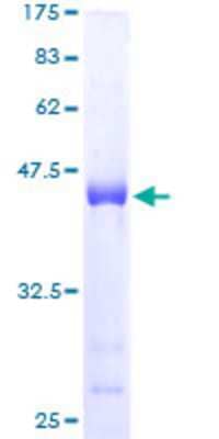12.5% SDS-PAGE Stained with Coomassie Blue.