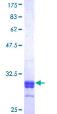 SDS-Page: Recombinant Human SRD5A2 Protein [H00006716-Q01] - 12.5% SDS-PAGE Stained with Coomassie Blue.