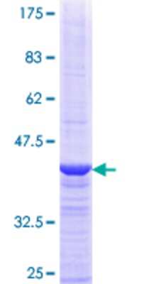 SDS-Page: Recombinant Human SRP68 Protein [H00006730-Q01] - 12.5% SDS-PAGE Stained with Coomassie Blue.