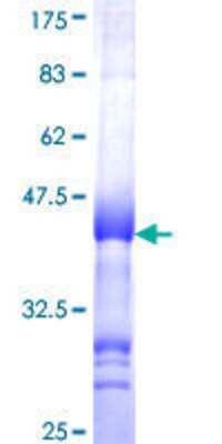 12.5% SDS-PAGE Stained with Coomassie Blue.