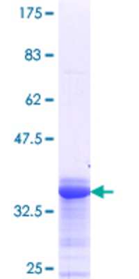 12.5% SDS-PAGE Stained with Coomassie Blue.