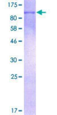 Recombinant Human STAT6 Protein [H00006778-P01] - 12.5% SDS-PAGE Stained with Coomassie Blue. Band visible at molecular weight of approximately 100 kDa.