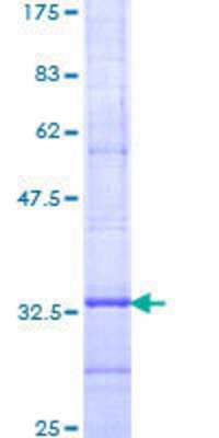 SDS-Page: Recombinant Human ELOVL4 Protein [H00006785-Q01] - 12.5% SDS-PAGE Stained with Coomassie Blue.