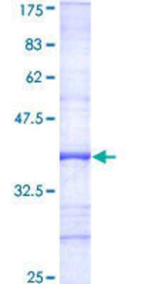SDS-Page: Recombinant Human LOK Protein [H00006793-Q01] - 12.5% SDS-PAGE Stained with Coomassie Blue.