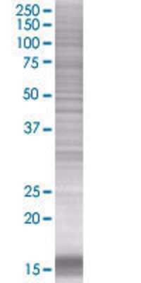 STK10 transfected lysate.