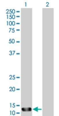 Lane 1: STK10 transfected lysate (14.74 KDa) Lane 2: Non-transfected lysate.