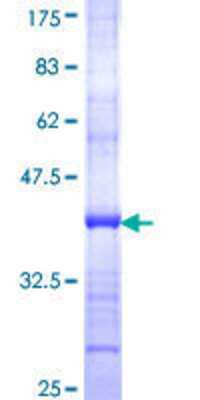SDS-Page: Recombinant Human Suppressor of Ty 4 homolog 1 Protein [H00006827-Q01] - 12.5% SDS-PAGE Stained with Coomassie Blue.