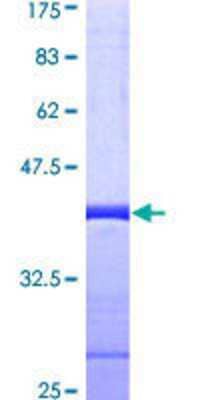 SDS-Page: Recombinant Human SUPT5H Protein [H00006829-Q01] - 12.5% SDS-PAGE Stained with Coomassie Blue.