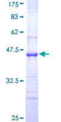 12.5% SDS-PAGE Stained with Coomassie Blue.