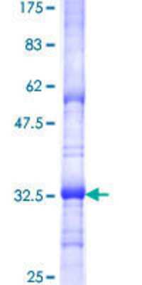 SDS-Page: Recombinant Human SURF4 Protein [H00006836-Q01] - 12.5% SDS-PAGE Stained with Coomassie Blue.