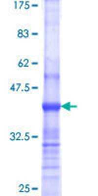 SDS-Page: Recombinant Human Supervillin Protein [H00006840-Q01] - 12.5% SDS-PAGE Stained with Coomassie Blue.