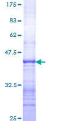 12.5% SDS-PAGE Stained with Coomassie Blue.