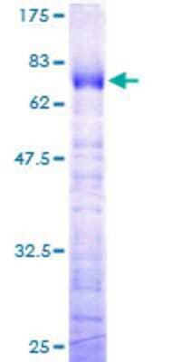 SDS-Page: Recombinant Human TFIISH Protein [H00006920-P01] - 12.5% SDS-PAGE Stained with Coomassie Blue.