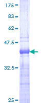 12.5% SDS-PAGE Stained with Coomassie Blue.