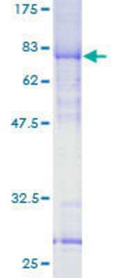 SDS-Page: Recombinant Human YL1 Protein [H00006944-P01] - 12.5% SDS-PAGE Stained with Coomassie Blue.