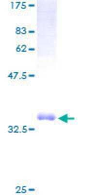 12.5% SDS-PAGE Stained with Coomassie Blue.