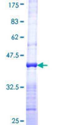 Recombinant Human TEP1 Protein [H00007011-Q01] - 12.5% SDS-PAGE Stained with Coomassie Blue.