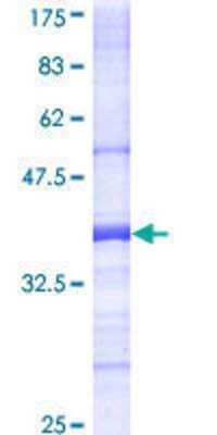 12.5% SDS-PAGE Stained with Coomassie Blue.