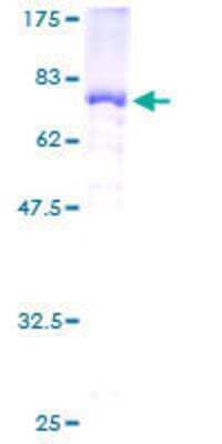 12.5% SDS-PAGE Stained with Coomassie Blue.