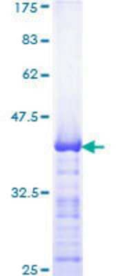 SDS-Page: Recombinant Human AP-2 beta/TFAP2B Protein [H00007021-Q01] - 12.5% SDS-PAGE Stained with Coomassie Blue.