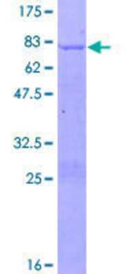 12.5% SDS-PAGE Stained with Coomassie Blue.
