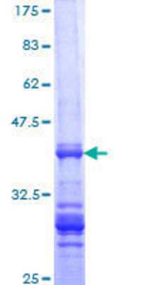 SDS-Page: Recombinant Human TGIF1 Protein [H00007050-Q01] - 12.5% SDS-PAGE Stained with Coomassie Blue.
