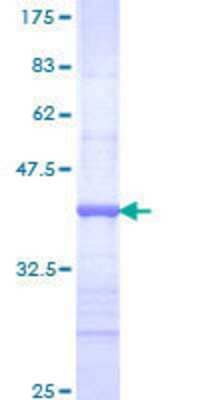 12.5% SDS-PAGE Stained with Coomassie Blue.