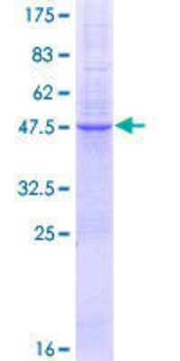 SDS-Page: Recombinant Human TSPAN8/TM4SF3 Protein [H00007103-P02] - 12.5% SDS-PAGE Stained with Coomassie Blue.