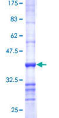 12.5% SDS-PAGE Stained with Coomassie Blue.