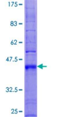 12.5% SDS-PAGE Stained with Coomassie Blue.