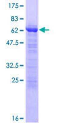 Recombinant Human Tropomodulin 1 Protein [H00007111-P01] - 12.5% SDS-PAGE Stained with Coomassie Blue.