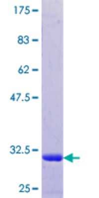 12.5% SDS-PAGE Stained with Coomassie Blue.