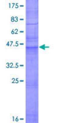 Recombinant Human Claudin-5 Protein [H00007122-P01] - 12.5% SDS-PAGE Stained with Coomassie Blue.