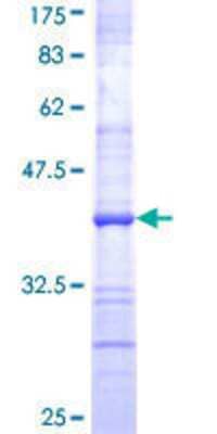 12.5% SDS-PAGE Stained with Coomassie Blue.